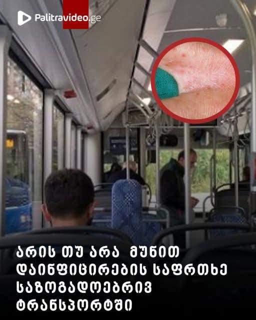 არის თუ არა მუნით დაინფიცირების საფრთხე საზოგადოებრივ ტრანსპორტში