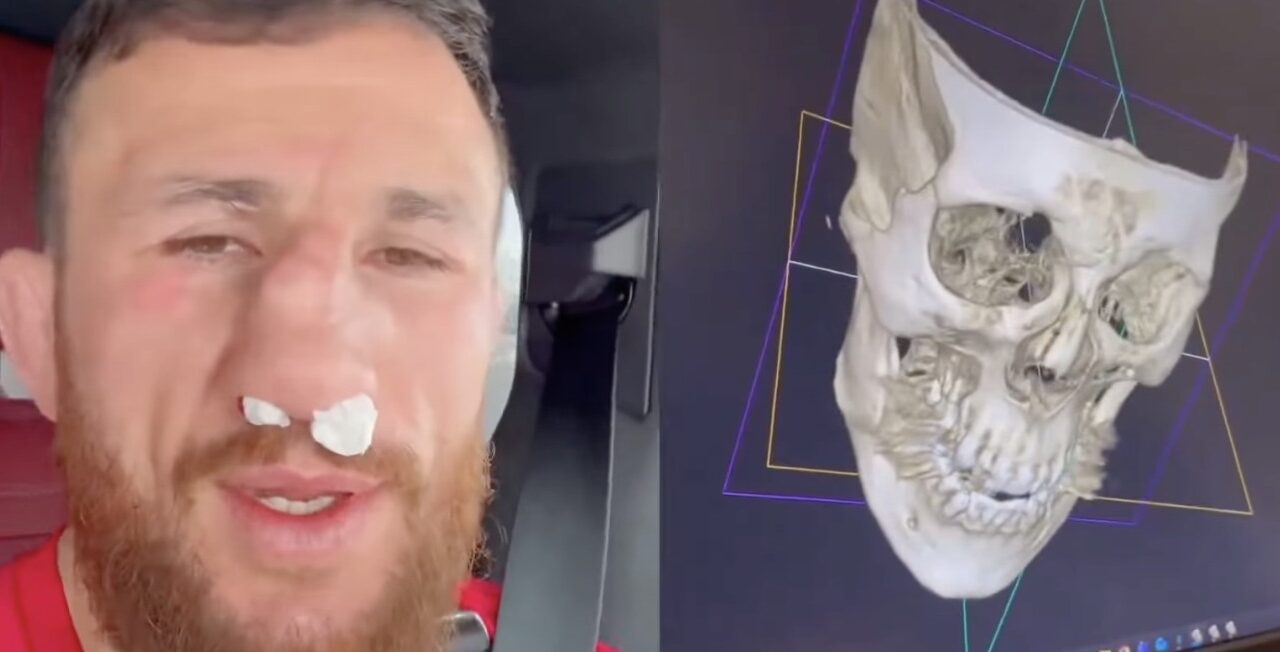 ძალიან მძიმე დაზიანებაა მიიღო მერაბ დვალიშვილმა