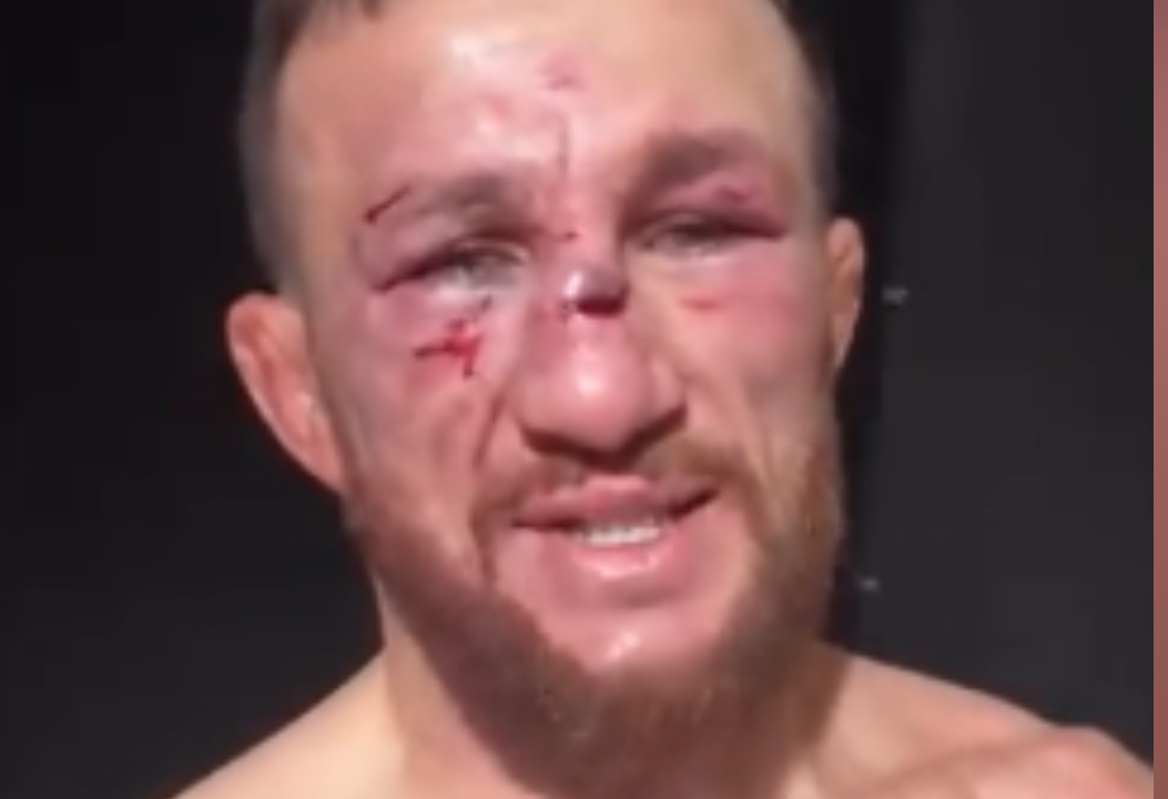 ძალიან მძიმე დაზიანებაა მიიღო მერაბ დვალიშვილმა